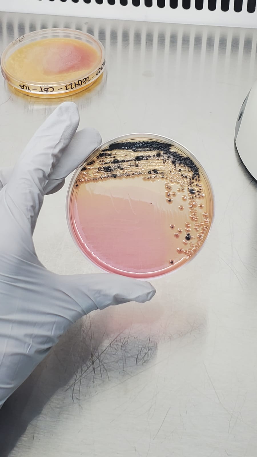 Detecci N De Salmonella En Alimentos An Lisis Microbiol Gicos E